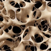 traitement naturel nacre ostéoporose